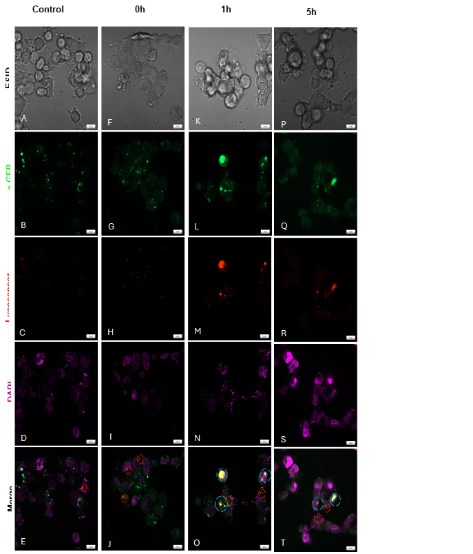 Figure 1: HEK-293 RAD51B transfection